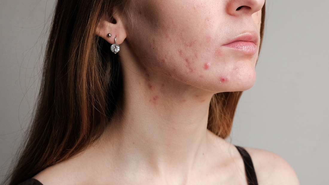 9 Essential Face Lotion for Sensitive Skin Picks in 2026