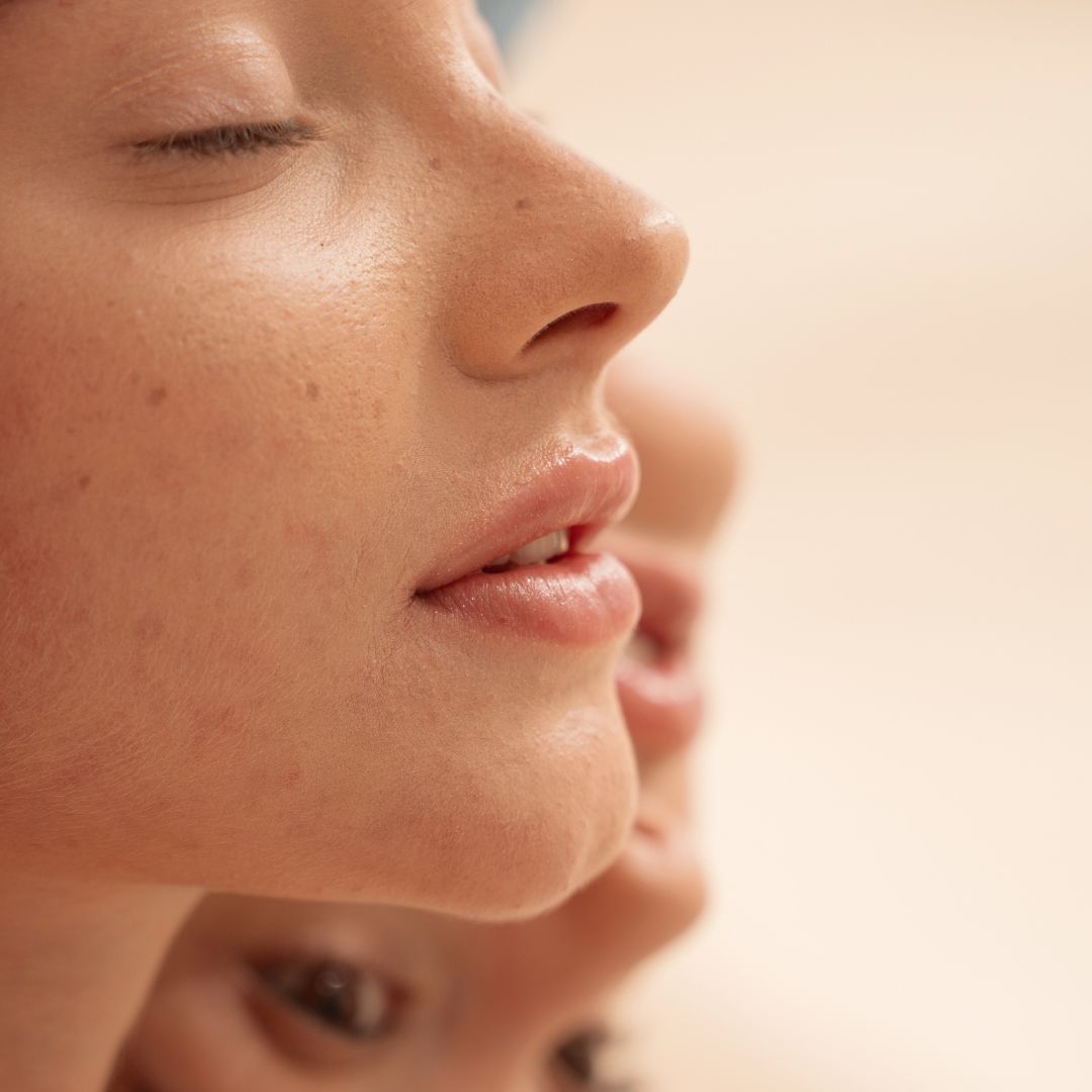 Why Urea Is the Secret to Smoother, Healthier Skin: A Dermatologist-Trusted Ingredient for Dry, Flaky Skin & Keratosis Pilaris