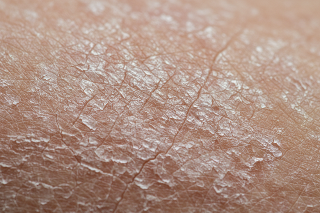 9 Essential Face Lotion for Dry Sensitive Skin Picks for 2025